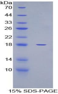 Human GAPDH Protein (Recombinant His)