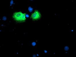 IDS / Iduronate 2 Sulfatase Antibody (clone OTI4G2)