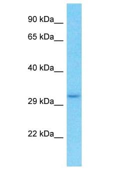 OR6M1 Antibody (aa194-243)