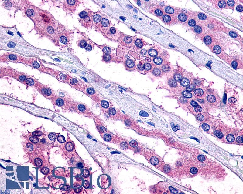 IHC-plus™ PTGER2 / EP2 Antibody (Extracellular Domain)