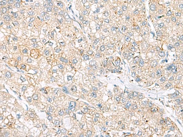 FARP2 / FRG Antibody