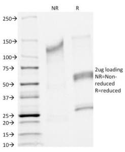 CFTR Antibody (clone CFTR/1341)
