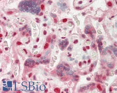 IHC-plus™ Monoclonal Mouse anti-Human GTF2I / TFII I Antibody (clone 3E2, IHC, IF, WB)