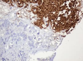PARVB Antibody (clone OTI2H1)