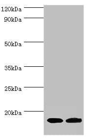 Polyclonal Rabbit anti-Human CPLX2 / Complexin 2 Antibody (aa1-134, WB)
