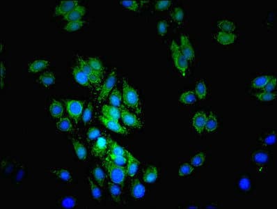 Polyclonal Rabbit anti-Human LIPA / Lysosomal Acid Lipase Antibody (aa22-399, WB)