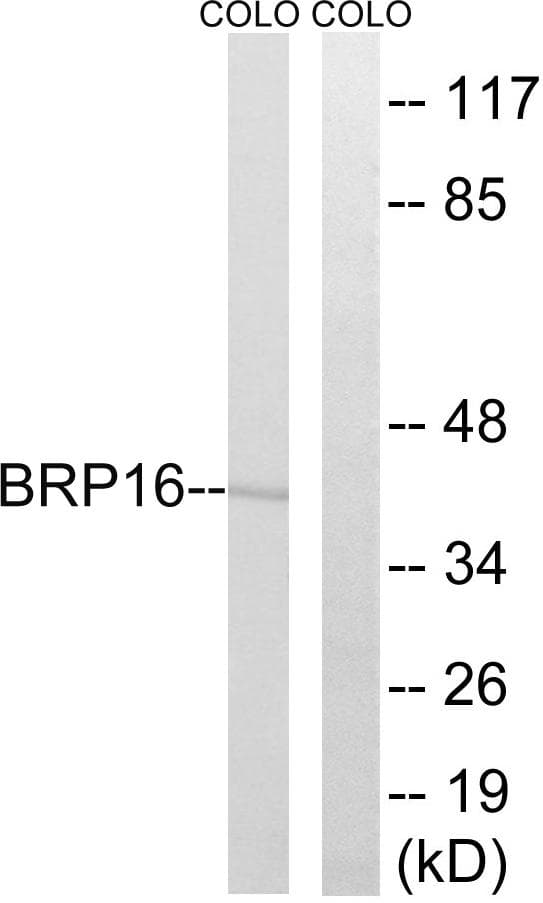 HGH1 / FAM203A Antibody