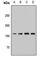Polyclonal Rabbit anti-Human KDM6A / UTX Antibody (WB)