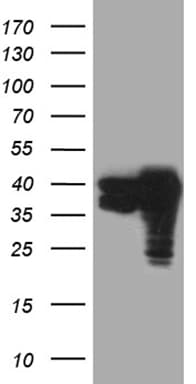 Monoclonal Mouse anti-Human TALDO1 / Transaldolase 1 Antibody (clone OTI4A7, Carrier-free, WB)