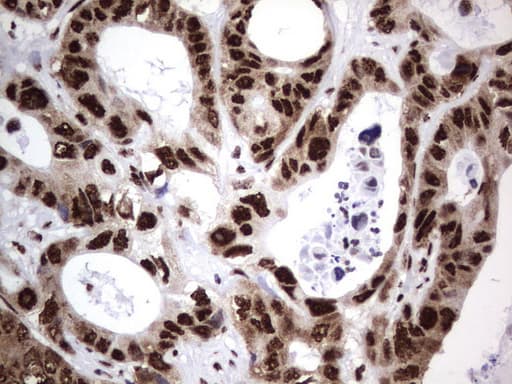 DDX56 Antibody (aa323-547, clone UMAB153)