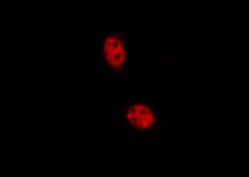 SMAD3 Antibody (phospho-Ser213)