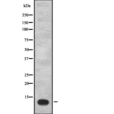 IGFL1 Antibody