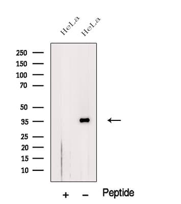 CTG-B45d / THAP11 Antibody