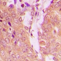 TPH1 / Tryptophan Hydroxylase Antibody (N-Terminus)