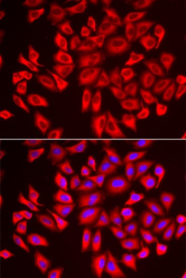 Polyclonal Rabbit anti-Human DCAF7 / WDR68 Antibody (IHC, IF, WB)