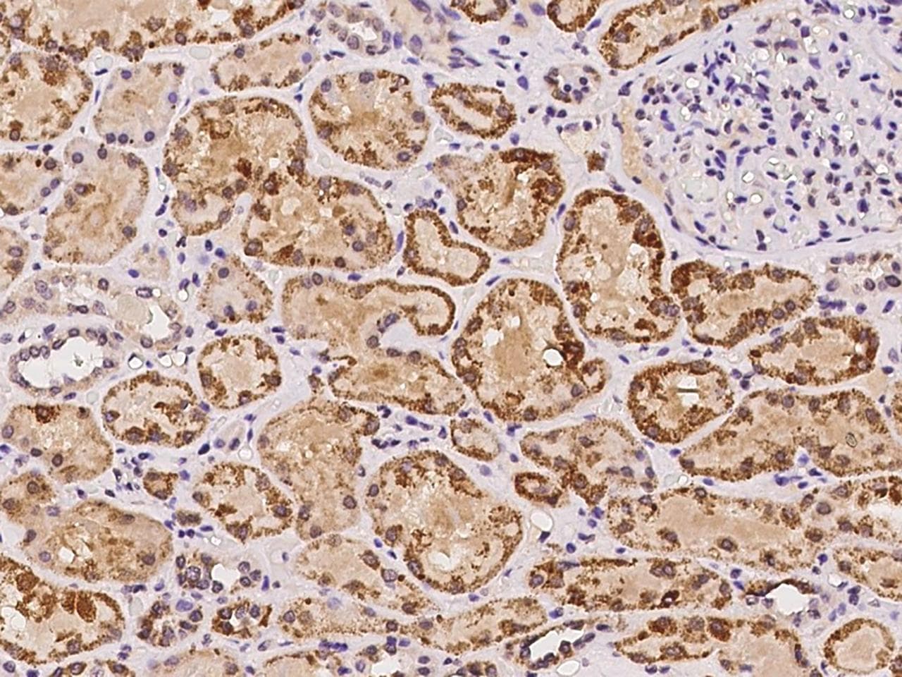 ZNF140 Antibody