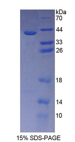 Human CD144 / CDH5 / VE Cadherin Protein (Recombinant His-T7)