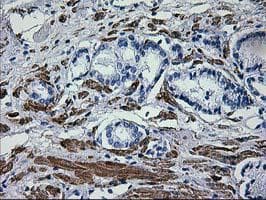 ERBB2 / HER2 Antibody (aa676-1255, clone OTI1D9, Carrier-free)