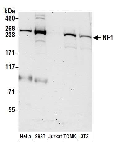 IHC-plus™ Neurofibromin / NF1 Antibody (aa2760-C-term)