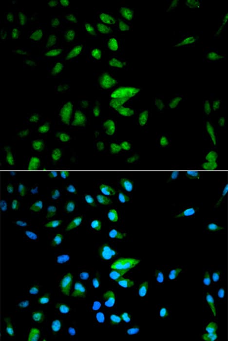 Polyclonal Rabbit anti-Human FOXO1 / FKHR Antibody (IF, WB)