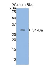 MYH7 Antibody (aa1268-1516, HRP)