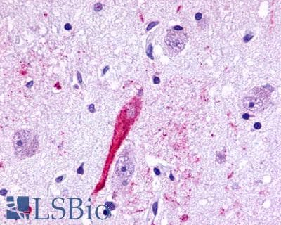 PathPlus™ TPRA1 / GPR175 Antibody (Cytoplasmic Domain)