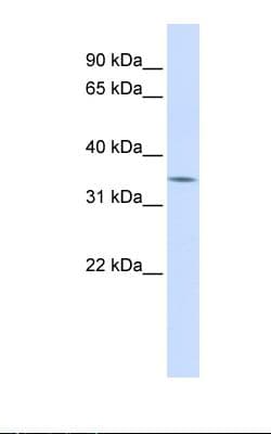 MARCH5 Antibody (C-Terminus)