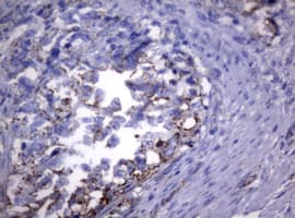 Monoclonal Mouse anti-Human PIK3CD / PI3K Delta Antibody (clone OTI1B5, aa286-610, IHC, WB)