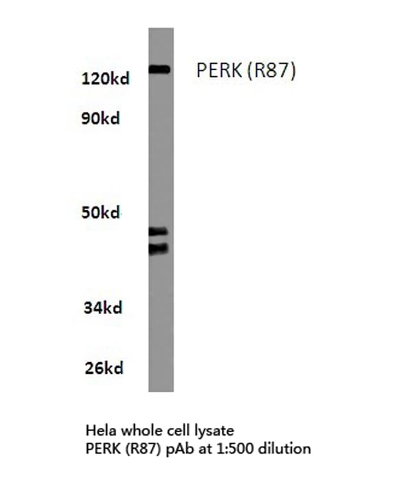 EIF2AK3 / PERK Antibody (Arg87)