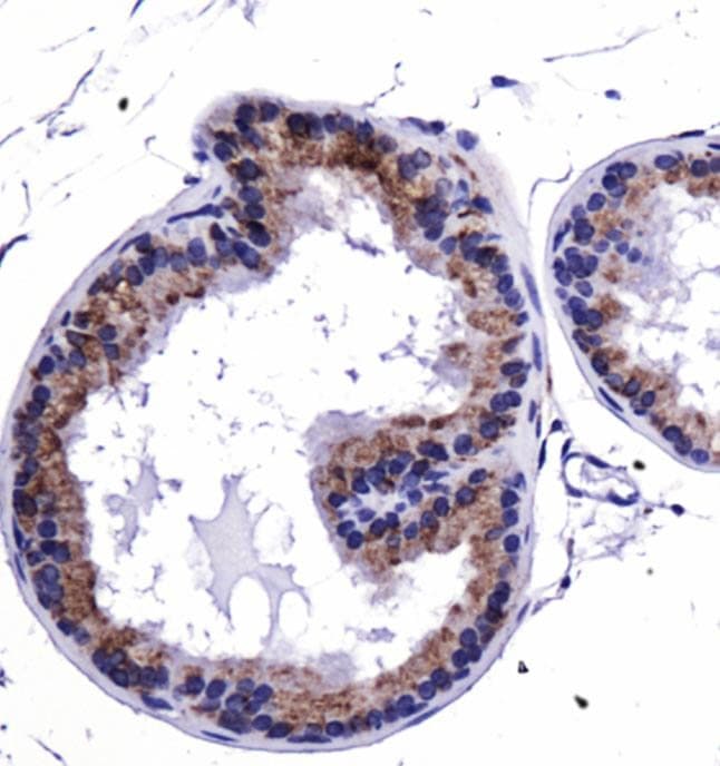 HSP90AB1 / HSP90 Alpha B1 Antibody (DY650)