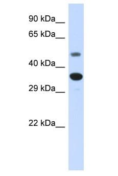 MAS1 / MAS Antibody (aa6-55)