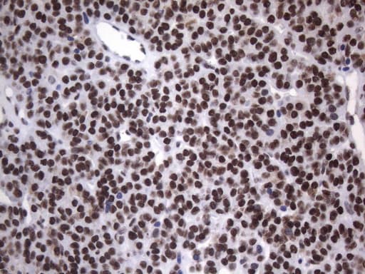 HnRNP A0 Antibody (aa139-183, clone OTI8H8)