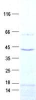Human SLC25A28 Protein (Recombinant His, N-Terminal)