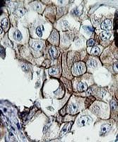ERBB2 / HER2 Antibody (aa676-1255, clone OTI5C3, Carrier-free)