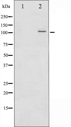 NFKB2 Antibody (phospho-Ser865)