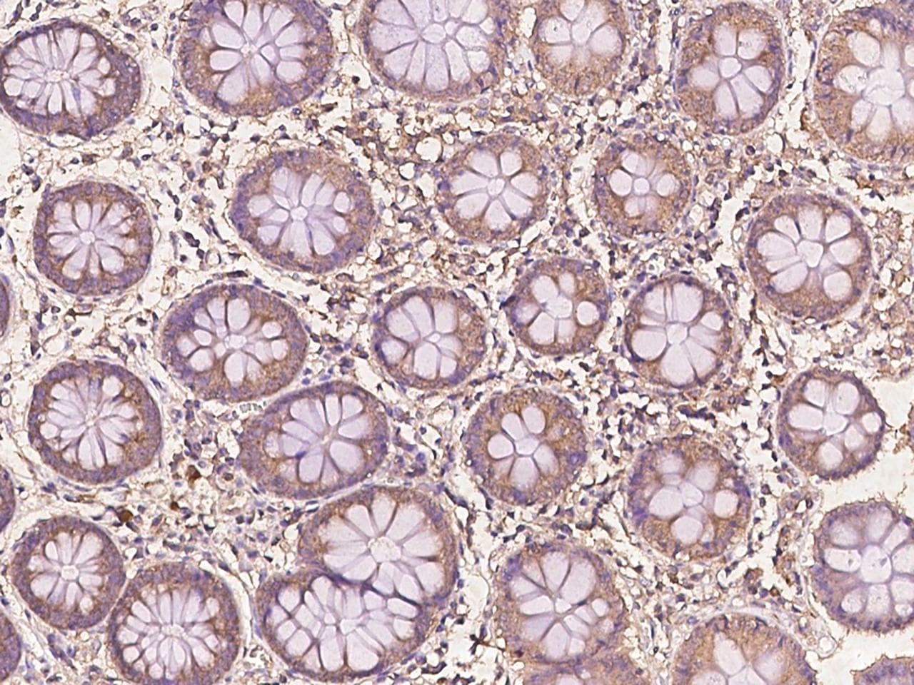 Polyclonal Rabbit anti-Human BTF3 Antibody (IHC, IF)