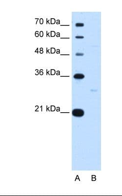 TEF Antibody (N-Terminus)