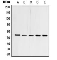Polyclonal Rabbit anti-Human TFDP1 Antibody (C-Terminus, IHC, IF, WB)