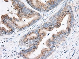 TTC32 Antibody (clone OTI3C2)