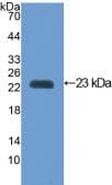 VCAM1 / CD106 Antibody (aa116-309, Cy3)