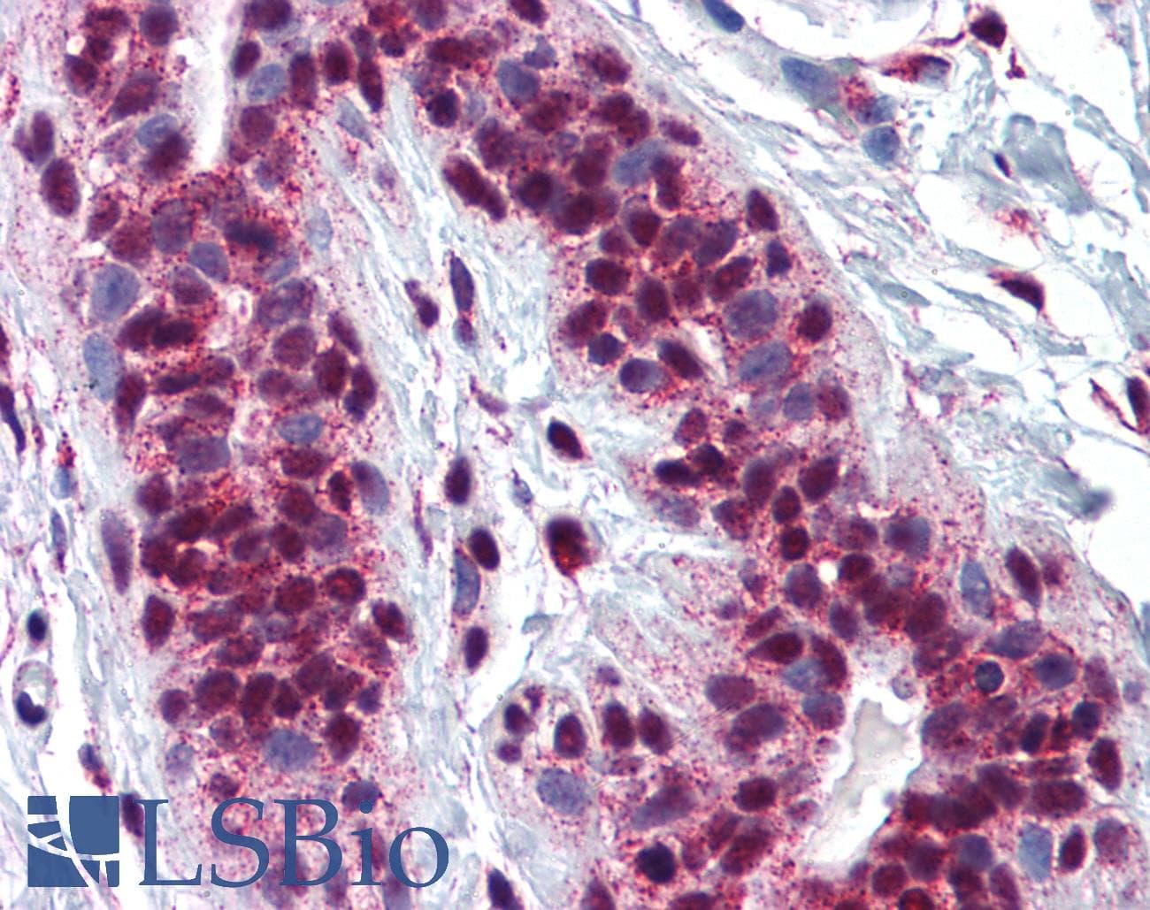 IHC-plus™ CREB1 / CREB Antibody (clone 5F2)