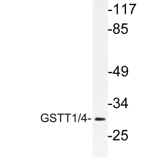 Polyclonal Rabbit anti-Human GSTT1 Antibody (Arg31, WB)