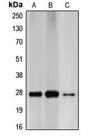 CDKN1B / p27 Kip1 Antibody (C-Terminus)