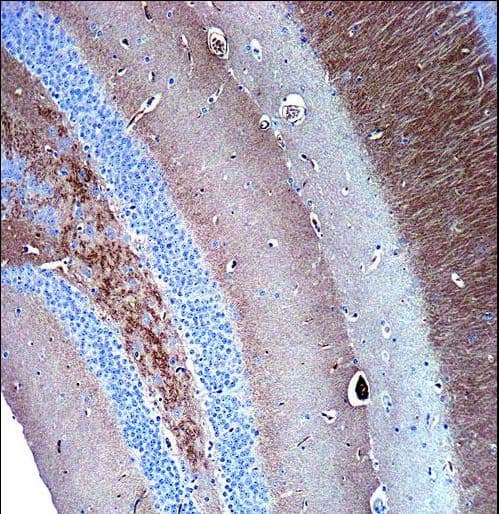 Polyclonal Rabbit anti-Human SYP / Synaptophysin Antibody (aa225-253, IHC, IF, WB)