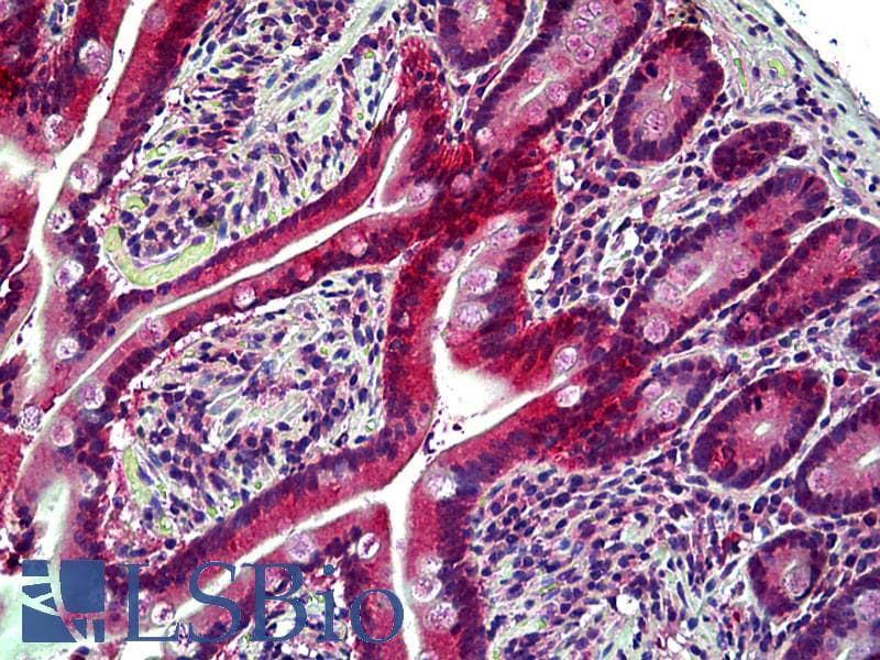 IHC-plus™ EPHB6 / EPH Receptor B6 Antibody (aa831-843)