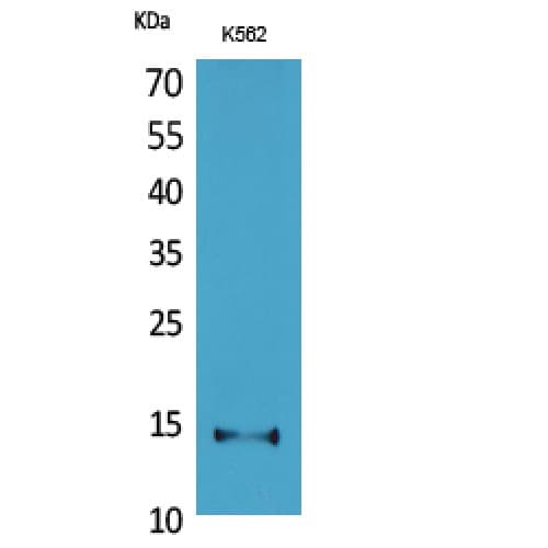 CD59 Antibody (41-90 aa, Internal)