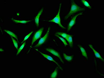 Polyclonal Rabbit anti-Human KIF1BP Antibody (IHC, IF)