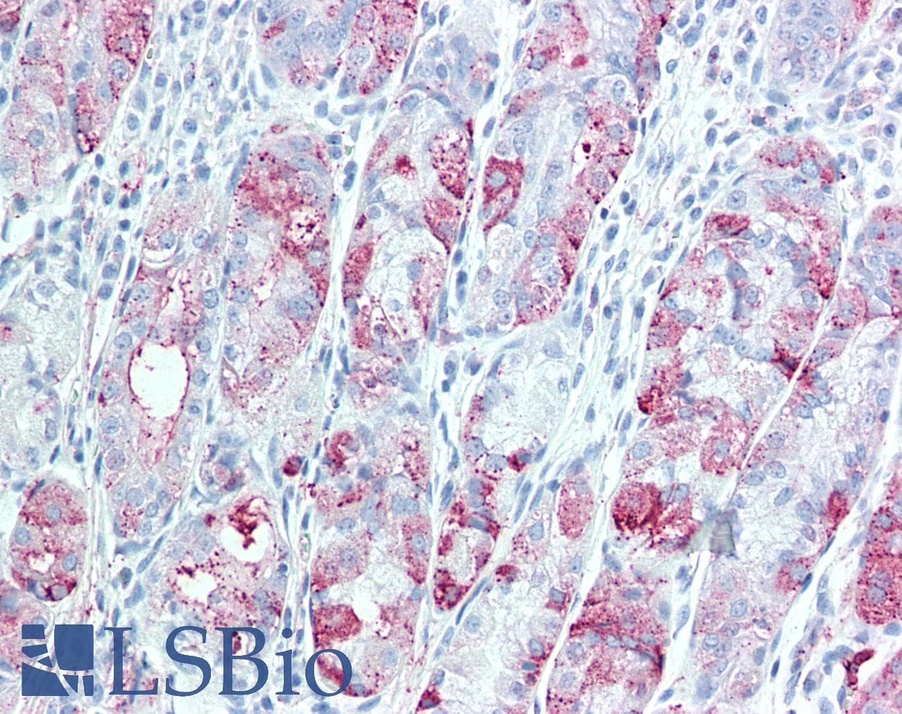 IHC-plus™ Polyclonal Rabbit anti-Human TSPAN13 / TM4SF13 Antibody (Internal, IHC)