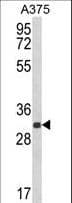 DERA Antibody (aa12-41)