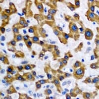 MAT / MAT1A Antibody